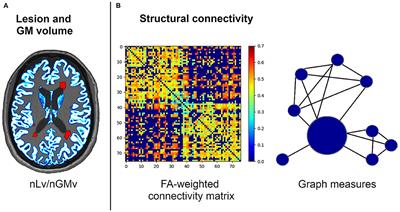 Impact of Cognitive Reserve and Structural Connectivity on Cognitive Performance in Multiple Sclerosis